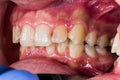 DIdactic exaples of dental problems