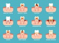 dental problems. different teeth damaged oral bad breath dental care information. Vector flat templates