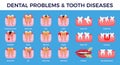 Dental Problems Diseases Infographic Set