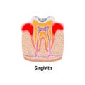 Dental Problems Poster