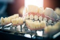 dental prostheses close-up. AI Generated Royalty Free Stock Photo