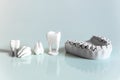 dental prostheses from the 3d printer