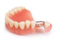 Dental prosthesis Royalty Free Stock Photo