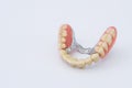 Dental prosthesis