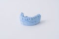 Dental prosthesis mold