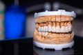 Dental Prosthesis Porcelain Zirconium Tooth