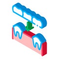 Dental Prosthesis Stomatology isometric icon vector illustration