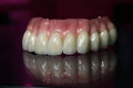 Dental prosthesis on the maxilla zirconia on implants