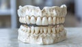 Dental prosthesis of the upper and lower jaws on a light background. Plaster cast of teeth Royalty Free Stock Photo