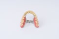 Dental prosthesis