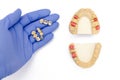 dental prosthetics background. fake teeth concept. crowns and bridges are in the dentist`s hand Royalty Free Stock Photo