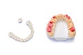 dental prosthetics. tooth restoration. ceramic white teeth. bridge prosthesis. Isolated on a white background Royalty Free Stock Photo