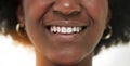 Dental, smile and teeth with closeup of person for medical, cosmetics and oral hygiene. Healthcare, orthodontics and