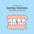 Dental spacing or diastema teeth illustration vector design on blue background. Dental care concept Royalty Free Stock Photo