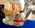 Dental study model