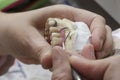 Dental technician doing partial dentures of acrylic resins.