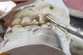 Dental technician doing partial dentures of acrylic resins.