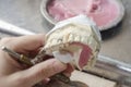 Dental technician doing partial dentures of acrylic resins.