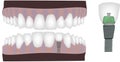 Dental technician dental instrument reconstruction