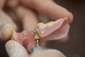 Dental technician make dental prothesis in dental laboratory