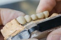 Dental technician placing the fixed partial denture. Royalty Free Stock Photo