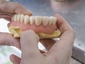 Dental technician is working with porcelain teeth in a cast mold Royalty Free Stock Photo