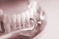 Dental teeth dentist model