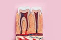 Dental teeth model on pink background. Royalty Free Stock Photo