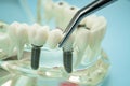 Dental teeth model with dentist tool for dentistry Royalty Free Stock Photo