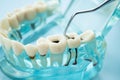 Dental teeth model with dentist tool for dentistry Royalty Free Stock Photo