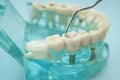 Dental teeth model with dentist tool for dentistry Royalty Free Stock Photo