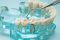 Dental teeth model with dentist tool for dentistry Royalty Free Stock Photo