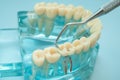 Dental teeth model with dentist tool for dentistry Royalty Free Stock Photo