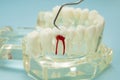 Dental teeth model with dentist tool for dentistry Royalty Free Stock Photo