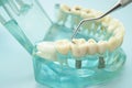 Dental teeth model with dentist tool for dentistry Royalty Free Stock Photo