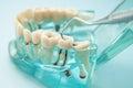 Dental teeth model with dentist tool for dentistry Royalty Free Stock Photo