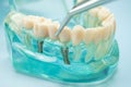 Dental teeth model with dentist tool for dentistry Royalty Free Stock Photo