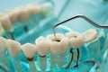 Dental teeth model with dentist tool for dentistry Royalty Free Stock Photo