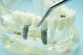 Dental teeth model with dentist tool for dentistry Royalty Free Stock Photo