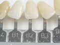 Dental teeth samples, dental color shade Royalty Free Stock Photo