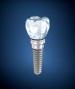 Dental titanium implant