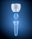 Dental titanium implant, x-ray view 3d
