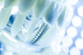 Dental titanium tooth implant