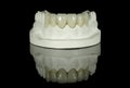 Dental Tooth Bridge