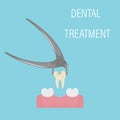 Dental tooth extraction. Exodontia. The tooth in the dental forceps. A white clean tooth is clamped between the forceps.