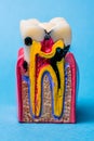 Dental tooth model showing decay and root canal Royalty Free Stock Photo