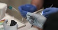 Dental treatment close-up. A dentist performs a dental procedure.