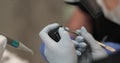 Dental treatment close-up. A dentist performs a dental procedure.