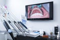Dental treatment tools Royalty Free Stock Photo