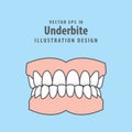 Dental underbite teeth illustration vector design on blue background. Dental care concept Royalty Free Stock Photo
